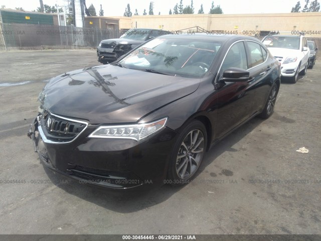 19UUB2F54HA000942 VI8008AX\
                 - ACURA TLX  2016 IMG - 1