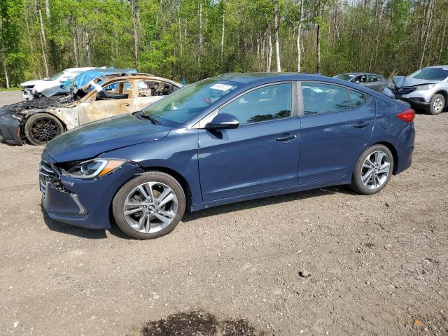 KMHD84LF9HU217905  - HYUNDAI ELANTRA SE  2017 IMG - 0