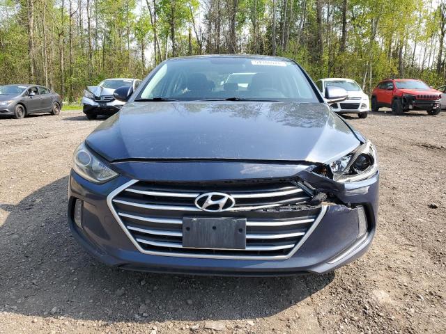 KMHD84LF9HU217905  - HYUNDAI ELANTRA SE  2017 IMG - 4